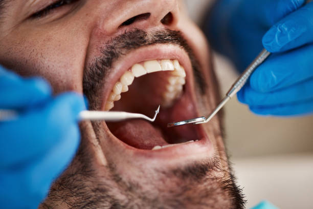 Best Emergency Dental Extractions in Rugby, ND