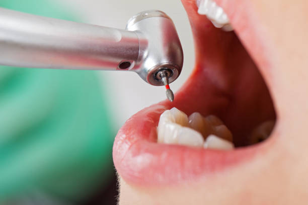 Best Pediatric Emergency Dentist in Rugby, ND